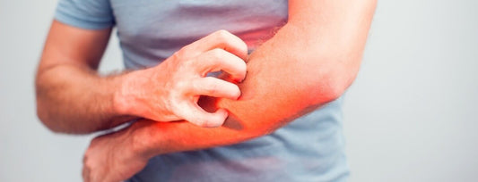 Are Quat Disinfectants Triggering Your Eczema & Skin Issues?